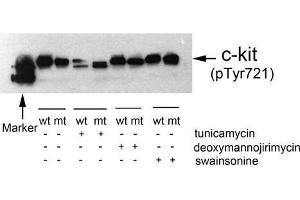 Western blot analysis of extracts from 293T cells(transfected with wild or mutant type c-kit/pc DNA3. (KIT anticorps  (pTyr721))