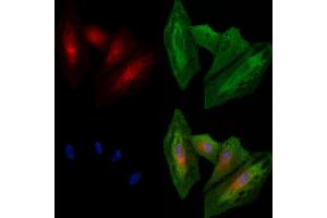 ABIN6260564 and ABIN6278557 staining  cells by IF/ICC. (CCRL2 anticorps  (Internal Region))