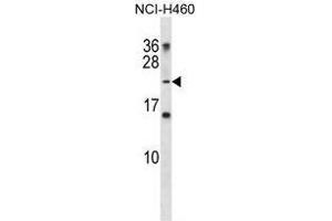 TNNI2 Antibody (N-term) western blot analysis in NCI-H460 cell line lysates (35 µg/lane). (TNNI2 anticorps  (N-Term))