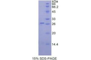 SDS-PAGE analysis of Human ADAM17 Protein. (ADAM17 Protéine)
