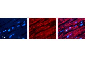 Rabbit Anti-CRY2 Antibody Catalog Number: ARP52398_P050 Formalin Fixed Paraffin Embedded Tissue: Human heart Tissue Observed Staining: Cytoplasmic Primary Antibody Concentration: 1:100 Other Working Concentrations: N/A Secondary Antibody: Donkey anti-Rabbit-Cy3 Secondary Antibody Concentration: 1:200 Magnification: 20X Exposure Time: 0. (CRY2 anticorps  (N-Term))