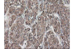 Image no. 5 for anti-Ribophorin 1 (RPN1) antibody (ABIN1500754)