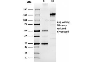 SDS-PAGE Analysis Purified Prolactin Mouse Monoclonal Antibody (PRL/2910). (Prolactin anticorps  (AA 63-201))