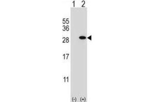Western Blotting (WB) image for anti-Glutathione S-Transferase theta 1 (GSTT1) antibody (ABIN2997016) (GSTT1 anticorps)