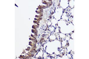 Immunohistochemistry of paraffin-embedded mouse lung using A Rabbit pAb (ABIN7265731) at dilution of 1:100 (40x lens). (ABCA8A anticorps)