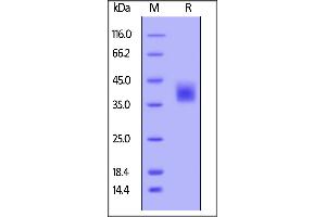 Human M-CSF, His Tag on  under reducing (R) condition. (M-CSF/CSF1 Protein (AA 33-255) (His tag))