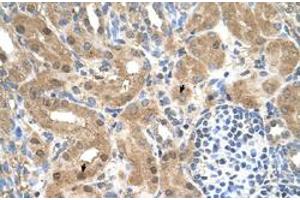 Immunohistochemical staining (Formalin-fixed paraffin-embedded sections) of human kidney with CCDC112 polyclonal antibody  at 4-8 ug/mL working concentration. (CCDC112 anticorps  (N-Term))