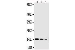 Anti-human NGF antibody, Western blotting Lane 1: Recombinant Human NGFB Protein 10ng Lane 2: Recombinant Human NGFB Protein 5ng Lane 3: Recombinant Human NGFB Protein 2 (Nerve Growth Factor anticorps  (AA 122-241))