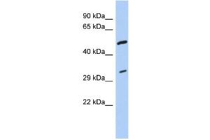 WB Suggested Anti-TPM3 Antibody Titration:  0. (TPM3 anticorps  (Middle Region))