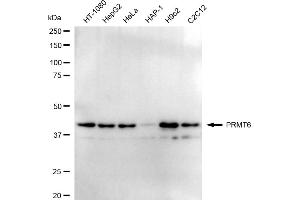 Western blotting analysis using PRMT6 antibody (ABIN7799972).