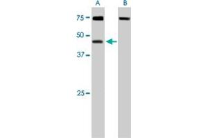 DYX1C1 polyclonal antibody  staining (0. (DYX1C1 anticorps)