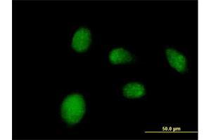 Immunofluorescence of purified MaxPab antibody to NANP on HeLa cell. (NANP anticorps  (AA 1-248))