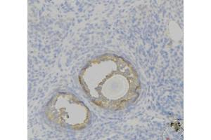 ABIN6276821 at 1/100 staining Human uterus tissue by IHC-P. (F12 anticorps  (C-Term))