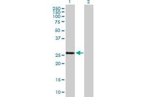 Western Blot analysis of BTG4 expression in transfected 293T cell line by BTG4 MaxPab polyclonal antibody. (BTG4 anticorps  (AA 1-206))