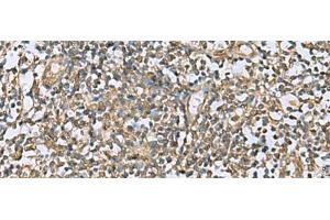Immunohistochemistry of paraffin-embedded Human tonsil tissue using LFNG Polyclonal Antibody at dilution of 1:60(x200) (LFNG anticorps)