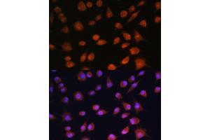 Immunofluorescence analysis of L929 cells using RPS19BP1 antibody (ABIN6132999, ABIN6147207, ABIN6147208 and ABIN6217154) at dilution of 1:100. (RPS19BP1 anticorps  (AA 1-136))