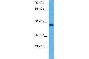 Host:  Rabbit  Target Name:  GAPDH  Sample Tissue:  Rat Brain  Antibody Dilution:  1ug/ml (GAPDH anticorps  (Middle Region))
