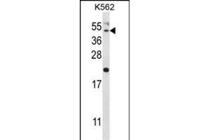 HAVCR1 Antibody (N-term) (ABIN657951 and ABIN2846896) western blot analysis in K562 cell line lysates (35 μg/lane). (HAVCR1 anticorps  (N-Term))