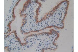 DAB staining on IHC-P; Samples: Mouse Vas Deferens Tissue (CD109 anticorps  (AA 890-1131))