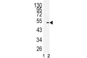 Western blot analysis of BMI1 antibody antibody and 293 lysate in the presence (1) and absence (2) of immunizing peptide.