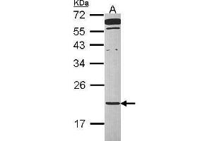 WB Image Sample (30 ug of whole cell lysate) A: Raji 12% SDS PAGE antibody diluted at 1:1000