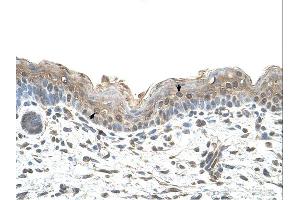 Ribophorin II antibody was used for immunohistochemistry at a concentration of 4-8 ug/ml. (Ribophorin II anticorps  (N-Term))