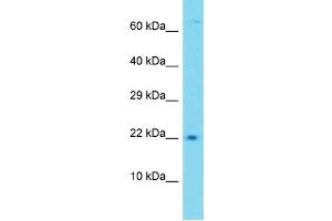 Western Blotting (WB) image for anti-Transmembrane Protein 52B (TMEM52B) (C-Term) antibody (ABIN2791294) (TMEM52B anticorps  (C-Term))