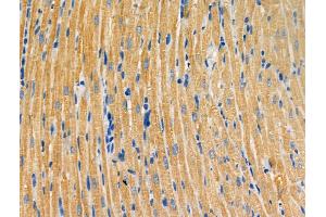 ABIN6259898 and ABIN6266940 at 1/100 staining Rat heart tissue by IHC-P.