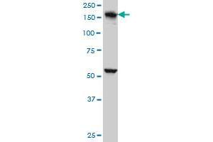 EEA1 monoclonal antibody (M02A), clone 1D4 Western Blot analysis of EEA1 expression in A-431 . (EEA1 anticorps  (AA 1312-1411))