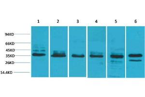 Western Blot (WB) analysis of 1) HeLa, 2) 293T, 3) C2C12, 4) Mouse Liver Tissue, 5) PC12, 6) Rat Brain Tissue with TBP Rabbit Polyclonal Antibody diluted at 1:2000. (TBP anticorps)