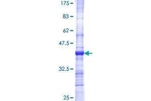 Image no. 1 for tRNA Splicing Endonuclease 34 Homolog (TSEN34) (AA 1-99) protein (GST tag) (ABIN1323873) (TSEN34 Protein (AA 1-99) (GST tag))