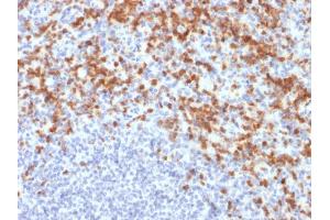Formalin-fixed, paraffin-embedded human spleen stained with MMP9 Mouse Recombinant Monoclonal Antibody (MMP9/2477).