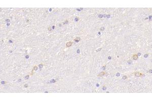 Detection of WNT5A in Mouse Cerebrum Tissue using Polyclonal Antibody to Wingless Type MMTV Integration Site Family, Member 5A (WNT5A)