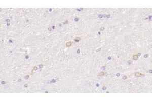 Detection of WNT5A in Mouse Cerebrum Tissue using Polyclonal Antibody to Wingless Type MMTV Integration Site Family, Member 5A (WNT5A) (WNT5A anticorps  (AA 62-380))