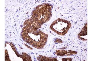 Image no. 7 for anti-Mucin 1 (MUC1) antibody (ABIN1499598)