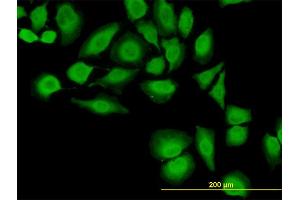 Immunofluorescence of monoclonal antibody to TXN on HeLa cell. (TXN anticorps  (AA 1-105))
