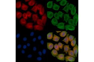 ABIN6262772 and ABIN6267008 staining Hela cells(45 min of heat-shock treatment) by IF/ICC. (KRT15 anticorps)