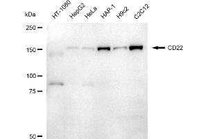 Western blotting analysis using CD22 antibody (ABIN7797958).