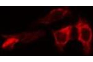 ABIN6266502 staining HeLa cells by IF/ICC.