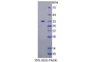SDS-PAGE analysis of Human TAT Protein.