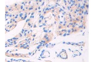 Used in DAB staining on fromalin fixed paraffin- embedded pancreas tissue (GAD anticorps  (AA 1-97))