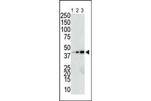 The anti-GST Pab (ABIN388090 and ABIN2843198) is used in Western blot to detect a GST-fusion recombinant protein (42 kDa) purified from bacterial lysate (Lanes 1-3: 10, 40, and 160 ng GST-fusion protein). (GST-Tag anticorps)