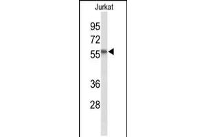 Western blot analysis of SACM1L Antibody in Jurkat cell line lysates (35ug/lane) (SACM1L anticorps  (C-Term))