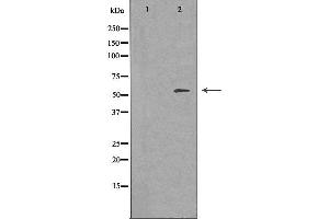 Western blot analysis of extracts from Jurkat cells, using FRK antibody. (FRK anticorps  (Internal Region))
