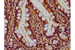 IHC image of ABIN7159941 diluted at 1:400 and staining in paraffin-embedded human small intestine tissue performed on a Leica BondTM system.
