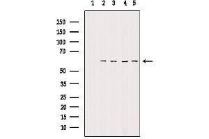 Western blot analysis of extracts from various samples, using TIGD2 Antibody. (TIGD2 anticorps)
