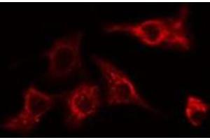 ABIN6275089 staining HeLa cells by IF/ICC. (MYLIP anticorps  (Internal Region))