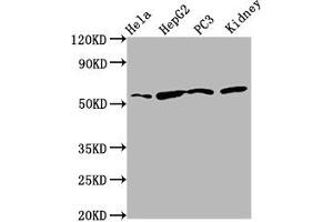 Western Blot Positive WB detected in: Hela whole cell lysate, HepG2 whole cell lysate, PC-3 whole cell lysate, Rat kidney tissue All lanes: TTI2 antibody at 8. (TTI2 anticorps  (AA 159-264))