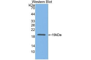 Western blot analysis of the recombinant protein. (Neuregulin 1 anticorps  (AA 328-486))