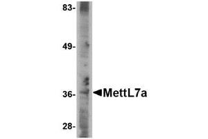 Image no. 1 for anti-Methyltransferase Like 7A (METTL7A) (C-Term) antibody (ABIN341690) (METTL7A anticorps  (C-Term))